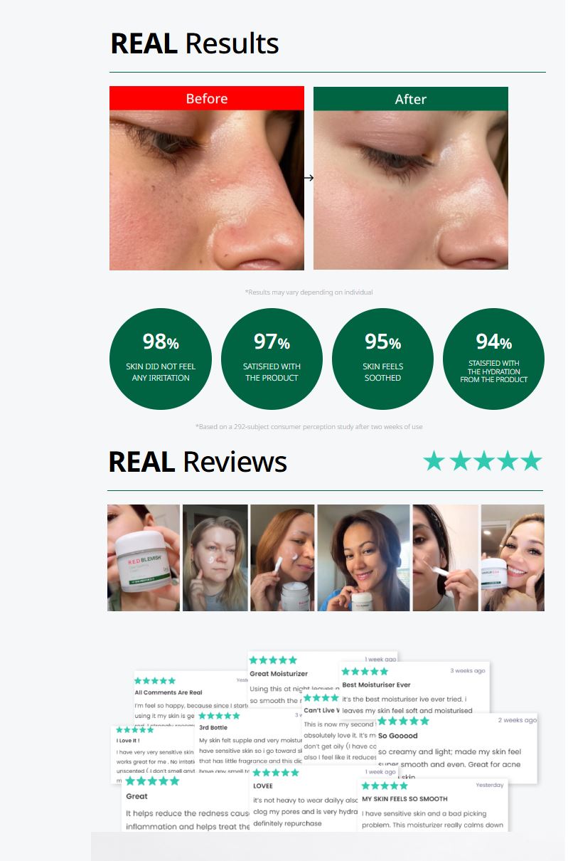 Dr.G Red Blemish Clear Soothing Cream