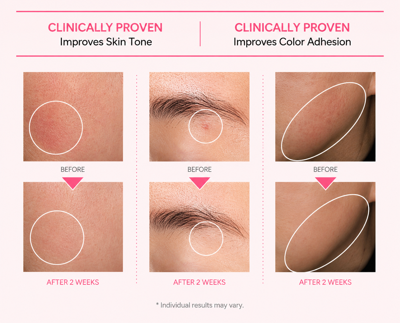 Anua Niacinamide 10 TXA 4% Serum